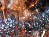 Tarantula Spider Infested with Nematode Worms [ Nematodes ]