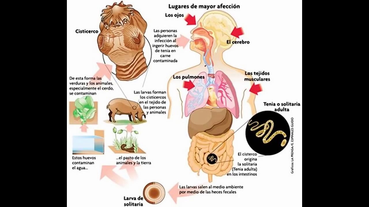 Enfermedad de chagas
