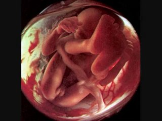 happy birthday  flipsyde   - sous titré en français