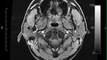 Open Source Brain Structural MRI Scan