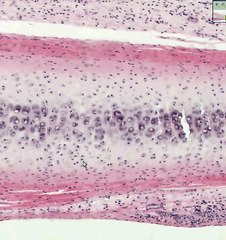 Shotgun Histology Hyaline Cartilage