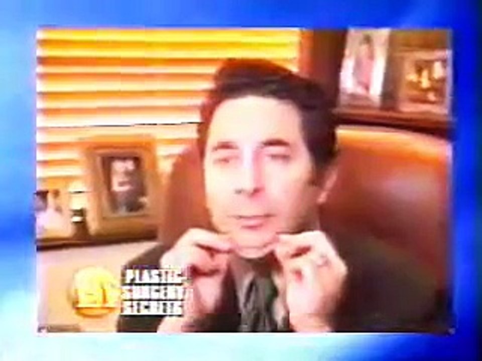 Full Face Makeover: Liposuction, Brow Lift, Eyelid Surgery, Lower Face Lift & Chin Implant