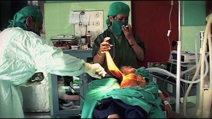 Burns surgery for Sum Maya HD - International Nepal Fellowship [INF]