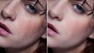 Photoshop Tutorials Photo Effects - How to Remove Acne in Photoshop  CS6