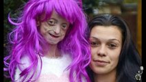 Teacher tells dying girl - who also suffers from alopecia - to remove wig