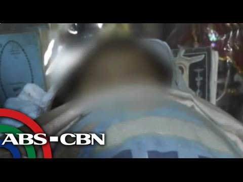 Dead child's head 'movement' stirs controversy