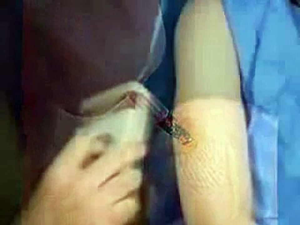 Stop The Human Implant Of The Verichip RFID