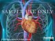 Coronary Artery Angioplasty (PCI, Heart Stent Surgery)