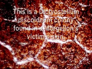 MORGELLONS: Dictyostelium discoideum