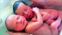 kendini anne karnında zanneden ikiz bebekler (twin babies in the womb, who thought himself)