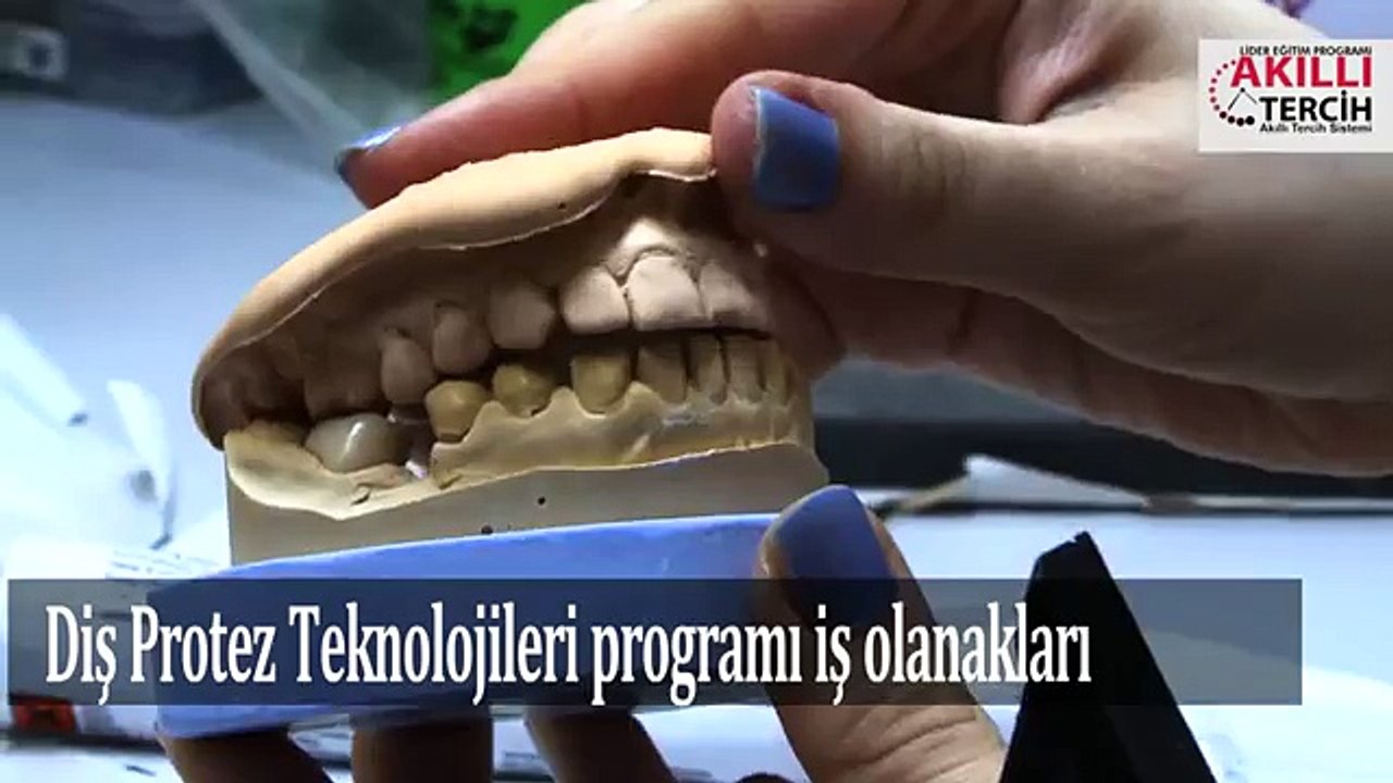 Diş Protez Teknolojilerinde  İş Olanakları Nelerdir?