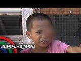 Lingkod Kapamilya: A boy with eye tumor calls for help