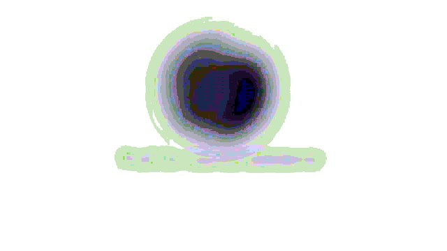 İple yüz germe uygulamasının etki süresi ne kadardır? - Prof. Dr. Gonca Gökdemir