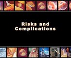 Risks and complications of IVF