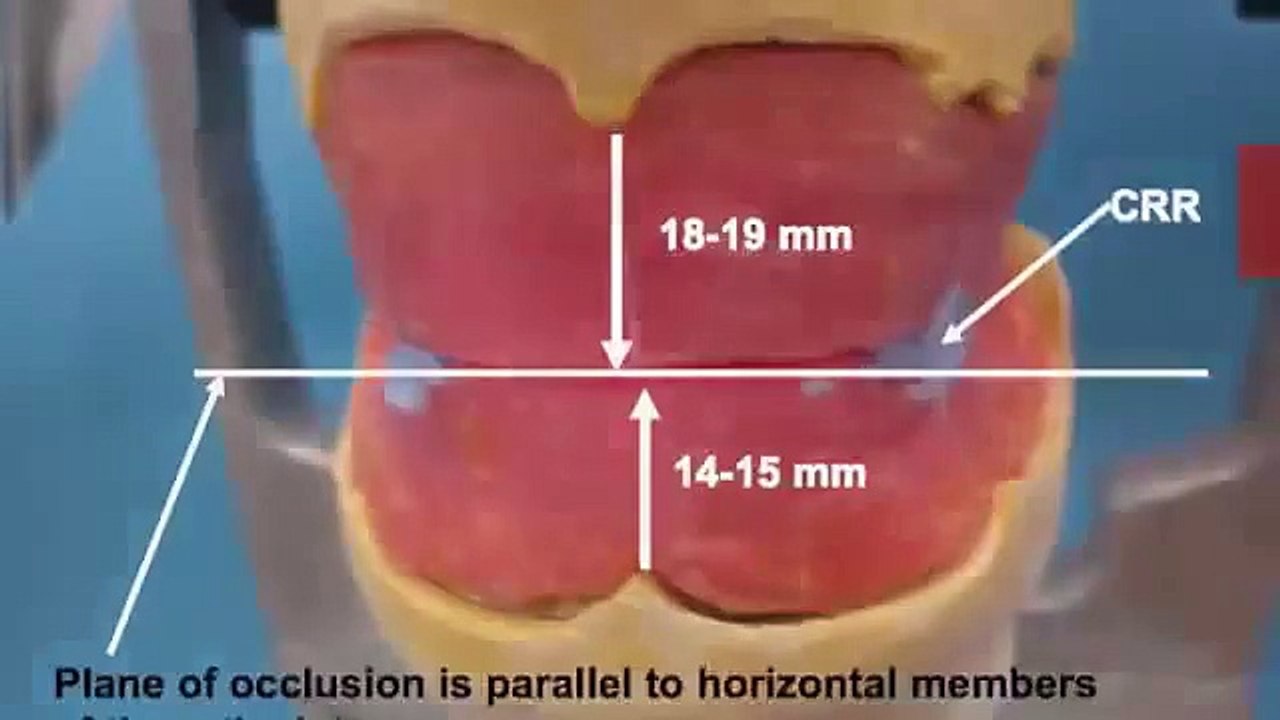 Wax rims for complete dentures