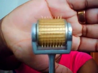 Stretch Mark Removal w/ Shea Butter and Dermaroller