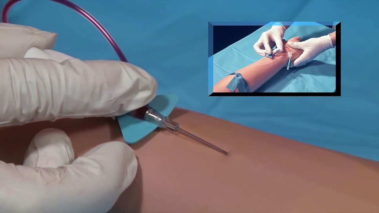 BD Nexiva Closed IV Catheter System - Points to Practice (UK Version)