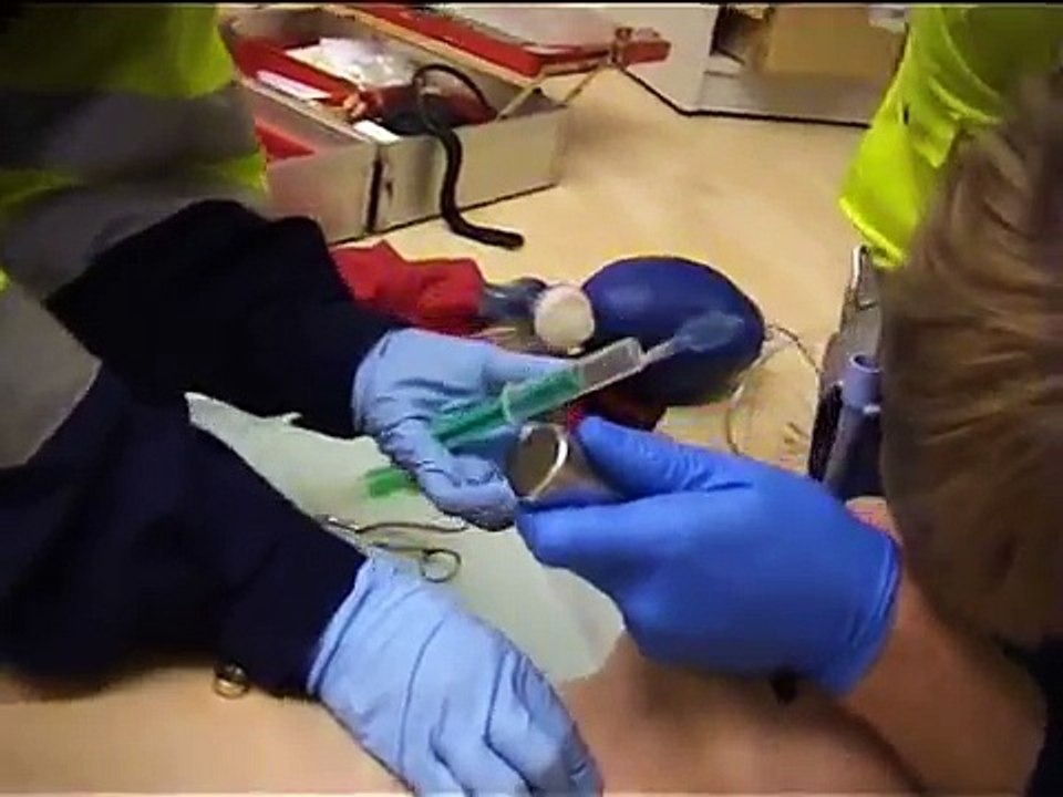 endotracheale Intubation