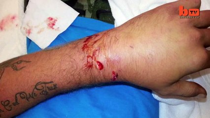 Alligator Attack Caught on Camera: Huge Reptile Snaps Man's Hand