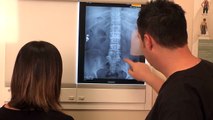Vertebral Compression Fracture  Explained by a Top Pain Physician in Las Vegas, Nevada