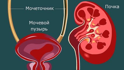 Лекарство от камней в почках(peresada86@yandex.ua,peresada86@gmail.com)