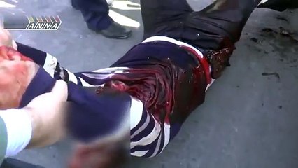 ANNA Syria Reporter Head Shot By Sniper !!