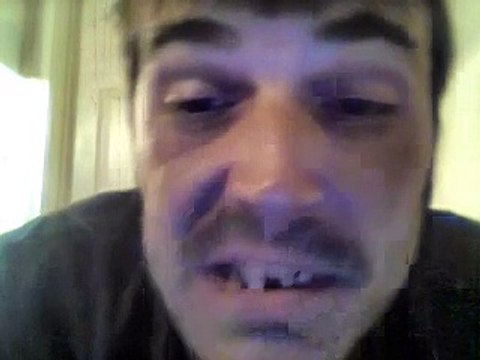 #Eminent #H.I.V Flow #LookAtMyfuckingEyesBitch #EminemOfTheSouth 05 - 29 - 2015 #SOSICKSHITGOTAIDS