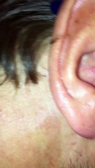 A man has something in his ear