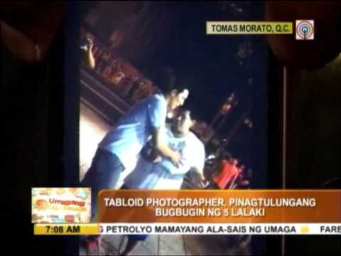 Photographer mauled over parking space