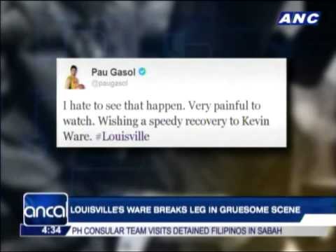 Louisville's Ware breaks leg in gruesome scene