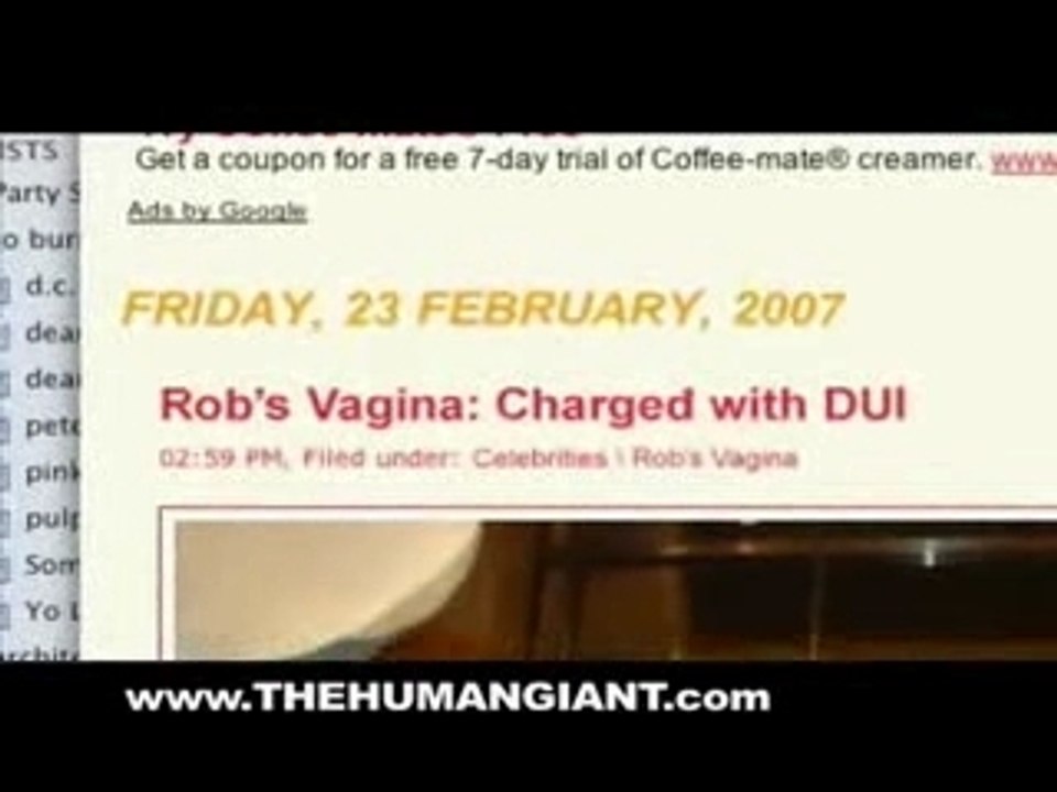MTV Human Giant: Rob’s Vagina - Leak