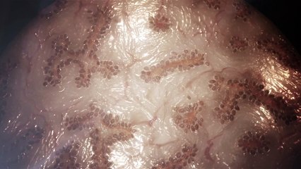 The Bioprinting Process