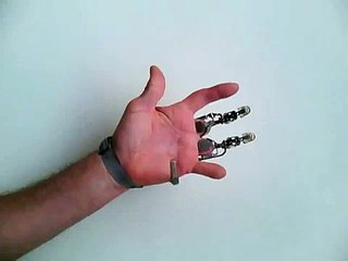 X-finger : la prothèse des doigts artificiels