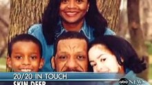 El Caso de Vitiligo de Desiree Simmons