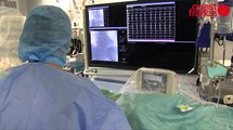 Le CHU de Rennes expérimente des LifeVest, véritable défibrillateur cardiaque portable