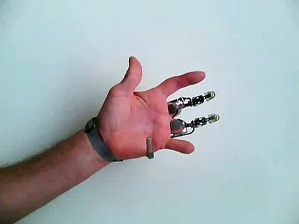 X-Fingers la prothèse de doigts artificiels
