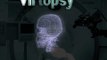 Virtopsy - Robotic Biopsy (CG)