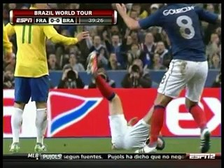 Francia vs Brazil | 2011