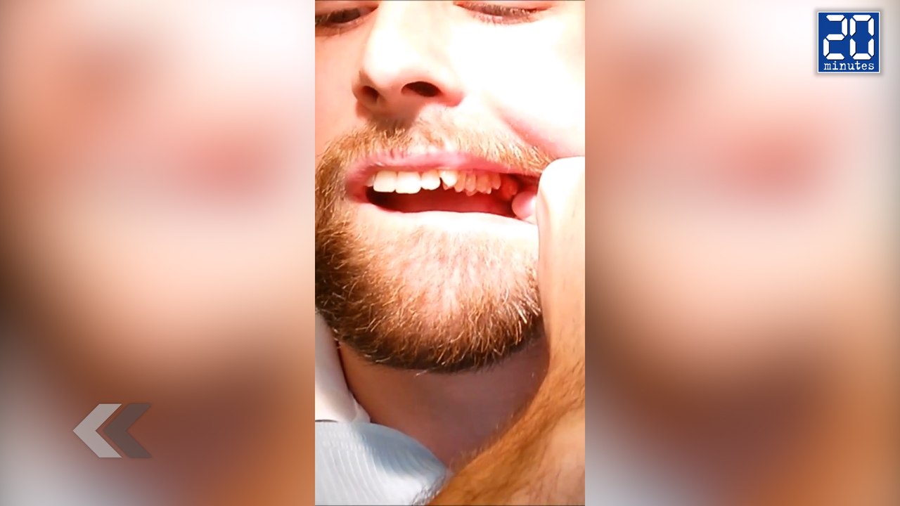 Un étudiant dentiste s'enlève une dent de sagesse tout seul - Le Rewind du Mardi 2 Juin 2015