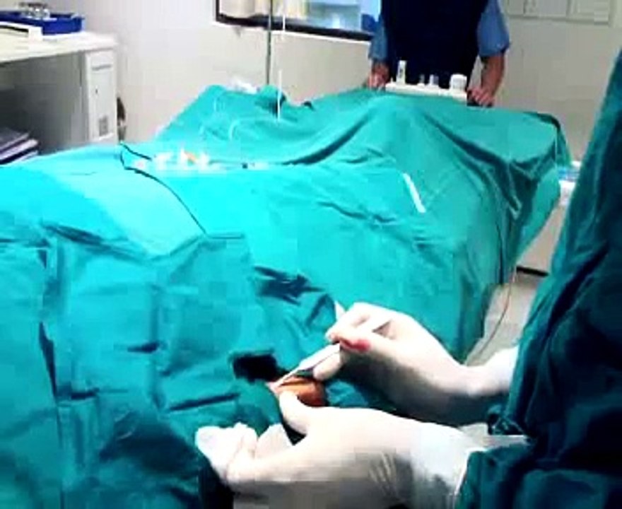 Dr. Narayan Gadkar, Cardiac Surgery, Performs Coronary Angiography & Coronary Angioplasty