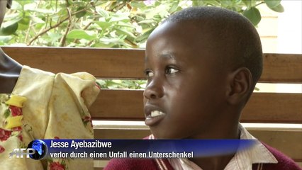 3-D-Technik ermöglicht amputierten Kindern neues Leben