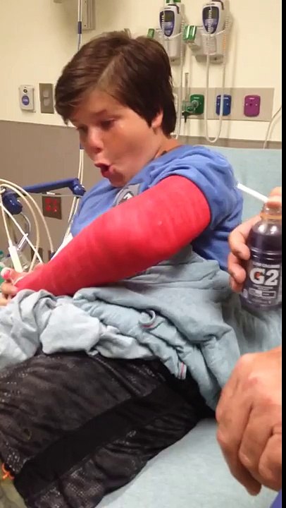 L'Insolite Réaction d'un Garçon qui Découvre qu'il a un Bras Cassé.. Plâtré !