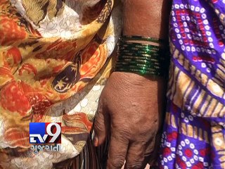 Row over hindu nurses not allowed to wear 'bindis' and 'Mangalsutra' at work, Vadodara - Tv9 Gujarat