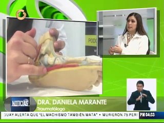 Pie plano es frecuente en bebés