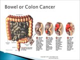 Pain in Left Side | Here are Major Causes of Stomach/Abdominal Pain in Left Side