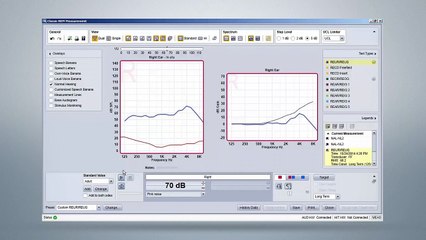 Siemens Unity 3 Real Ear Measurement - Tutorial