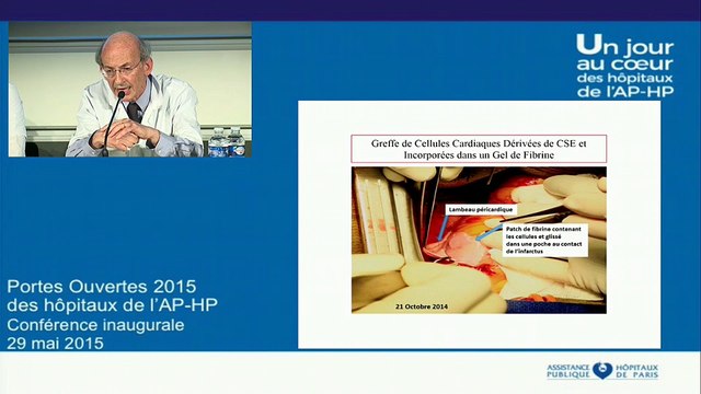 L'insuffisance cardiaque, un problème de santé publique : récentes innovations