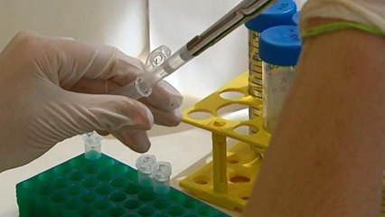 Un análisis de sangre descubre todos los virus que han afectado a una persona