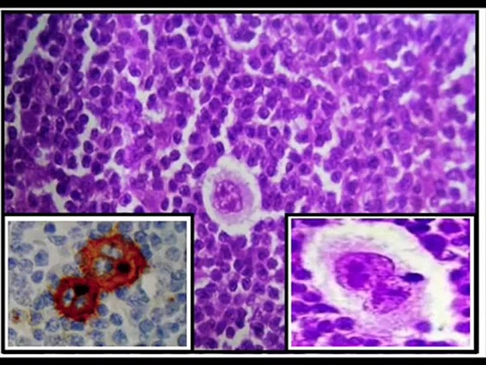 Sistema Imunológico -- O Antivírus Biológico