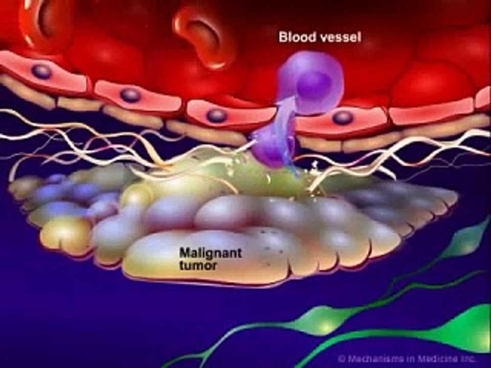 Fisiopatologia del cancer  3